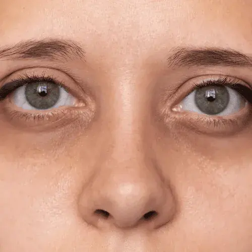 Tired, Dull, Washed-Out Skin